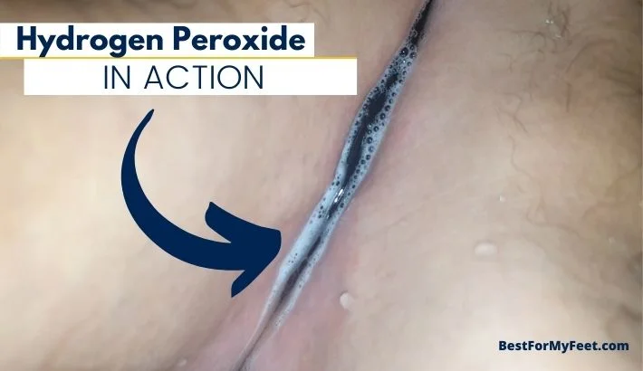 the reaction between the hydrogen peroxide and the human cells creates some bubbles for the first few minutes of the solution being in contact with your skin.